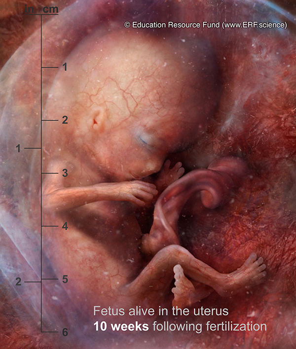 fetus at 10 wks -concept