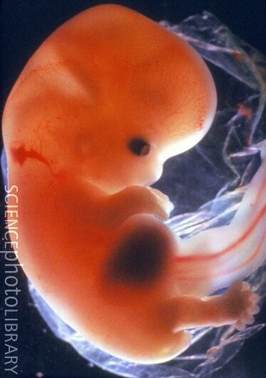 same-as-8-wk-gestation